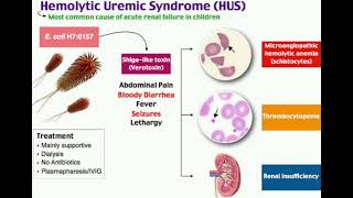 Hemolytic uremic syndrome  HUS  mrcpch Recall Communication [upl. by Artemus]