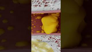 How to Remove Ear Wax Blockage the Right Way shorts facts  creativelearning3d [upl. by Sitrik537]