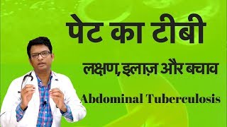 Abdominal tuberculosis  आंतों का टीबी  पेट का टीबी लक्षण इलाज़ और बचाव Dr Amit Gupta [upl. by Bertrand]