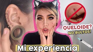 MIS PIERCINGS  EXPERIENCIA l QUELOIDES Como quitarlos Septum Medusa Nostril piercing oreja [upl. by Nikki]