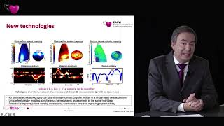 Highlights of EuroEcho 2019 [upl. by Aioj349]