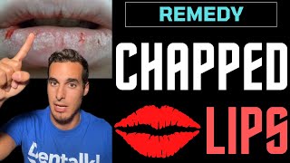 CHAPPED LIPS  Causes and REMEDIES for cracked lips [upl. by Lilly]