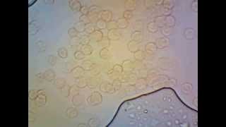 Live Blood Cells Under Microscope [upl. by Shank587]