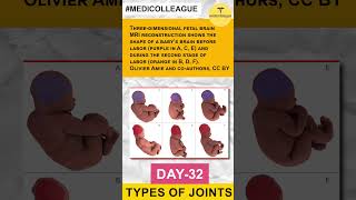 MEDICOLLEAGUE Understanding Different Types of Joints A Comprehensive Overview Joints Anatomy [upl. by Erminie739]