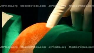 Shoulder Joint Injection Anterior Approach [upl. by Jedediah93]