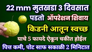 22 mm मूतखडा ३ दिवसात पडतोईडलिंबू गळलिंबू चे हे फायदे ऐकून चकित व्हालmutkhada idlimbu upay मुतखडा [upl. by Stryker]