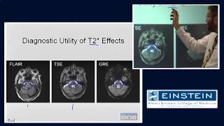 Introducing MRI MR Imaging of Hemorrhage 52 of 56 [upl. by Aihsoj135]