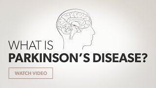 What is Parkinsons Disease [upl. by Jobie846]