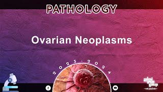 L5 Tut 2  Ovarian Neoplasms  Pathology [upl. by Elamef]