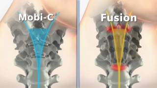 MobiC vs Fusion Animation [upl. by Lyris]