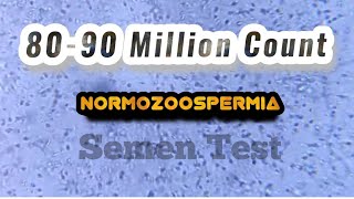 Normozoospermia semen Analysis [upl. by Atnom265]