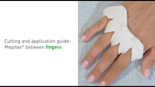 How to apply Mepilex between fingers [upl. by Emse]