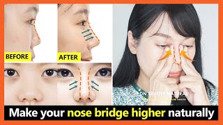 5 Best steps How to lift your nose bridge higher get perfect nose without surgery [upl. by Aciamaj]