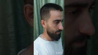 التدريج حلاقه barberacademy haircut حلاقين hairstyle اكسبلور تخرجhaircut [upl. by Ratcliffe89]