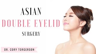 Asian Double Eyelid Surgery  Toronto  Dr Cory Torgerson [upl. by Kopans]