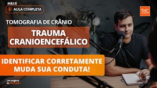 TRAUMA CRANIOENCEFÁLICO  Série Tomografia de Crânio Aula 2 [upl. by Ecirtnahc160]