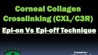 CORNEAL COLLAGEN CROSSLINKING EPION Vs EPIOFF TECHNIQUE HD [upl. by Lanrev]