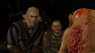 Witcher 3 Help Yenifer fix the Megascope  Part 10 [upl. by Kostman277]