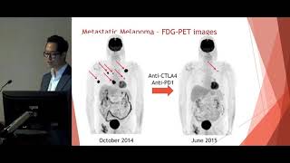 PRESENTATION Advances in Systemtic Treatment of Bladder Cancer  by Dr Michael Ong [upl. by Brause]