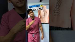 Rutina de estiramientos para escoliosis corrige tu escoliosis fisioterapia ejercicio [upl. by Reiter917]