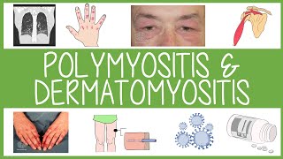 Polymyositis and Dermatomyositis in 3 Minutes [upl. by Foskett]