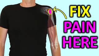 Front Shoulder Pain Fix the REAL cause of Biceps Tendonitis [upl. by Adlesirhc]