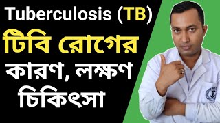 Tuberculosis TB টিবি রোগের লক্ষণ কি কি  Tuberculosis Infection in Bengali  Tuberculosis Test [upl. by Arakahs120]