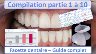 Facette dentaire  Guide complet  Compilation partie 1 à 10 [upl. by Eisinger794]