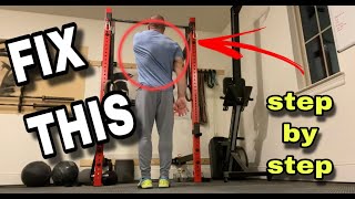 The ONLY Winged Scapula Fix THAT WORKS step by step  SmashweRx  Trevor Bachmeyer [upl. by Antoinetta]