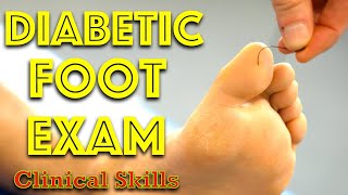 Diabetic Foot Examination  Clinical Skills  Dr Gill [upl. by Rhiana200]