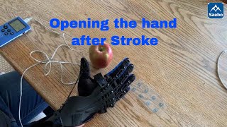 How to practice opening the hand after a neurological injury eg stroke [upl. by Gerdy]