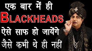 Blackheads जड़ से निकालने के लिए Remove Blackheads Permanently  Sanyasi Ayurveda [upl. by Huey]