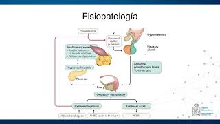 Fisiopatología Síndrome de Ovario Poliquístico [upl. by Anhoj404]