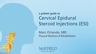 Cervical Epidural Steroid Injection [upl. by Ijies892]