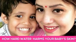 Is Hard Water Harming Your Baby’s Skin Know How This Gurugram Mom Saved Her Baby From It [upl. by Lebisor]