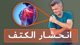 أسباب آلام الكتف انحشار الكتف، التهاب المفصل والتكلس [upl. by Savick]