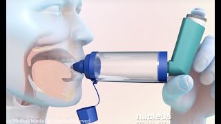 How to Use a Metered Dose Inhaler with a Spacer [upl. by Eelinej]