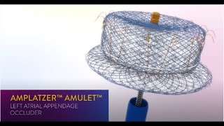 Guide to AFib and Stroke Risk Reduction – Amplatzer Amulet LAA Occluder [upl. by Eustazio207]