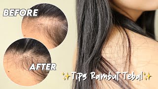 Cara Menebalkan Rambut  tips utk rambut rontok amp tipis 🫶 [upl. by Herrera615]