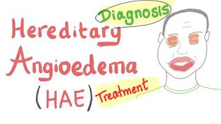 Hereditary Angioedema  Diagnosis and Treatment  Emergency Medicine [upl. by Cherye]