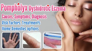 Pompholyx overview causes signs symptoms treatment option and home remedies  Dyshidrotic eczema [upl. by Trueman]