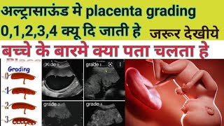 pregnancy ultrasound me placenta grade 01234 ka kya matlb hota he [upl. by Yesnek]