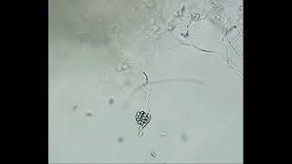 Release of Zoospores by Pythium sp [upl. by Nnovahs593]