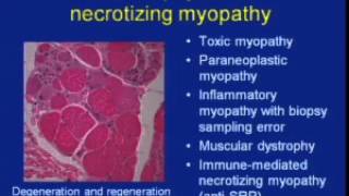 Autoimmunity Day at Johns Hopkins 2011 Part 4 [upl. by Lelith480]