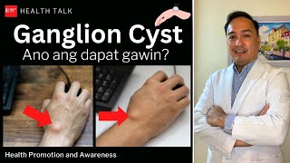 Ganglion Cyst Causes Risk factors Diagnosis Treatment and Prevention [upl. by Ezarras97]