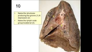 OSPE in anatomy of the respiratory system [upl. by Annaeg805]