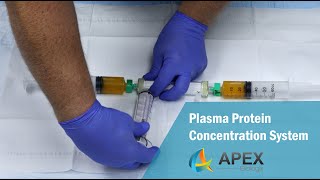 How to Obtain Concentrated Plasma Proteins HPH Junior [upl. by Yliab]