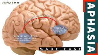 Aphasia 🧠 made easy  Speech Production  Definition  4 Types with diagram  Features  All details [upl. by Aratnahs543]