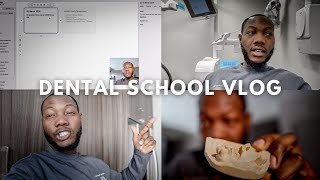 Dental School Vlog Preparing My Boards Study Schedule Fixed amp Removable Prosthodontics Are Back [upl. by Gilson]