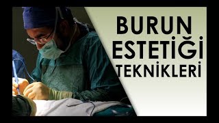 Burun Ameliyatı Teknikleri  Op Dr Ali Mezdeği [upl. by Hayidan754]